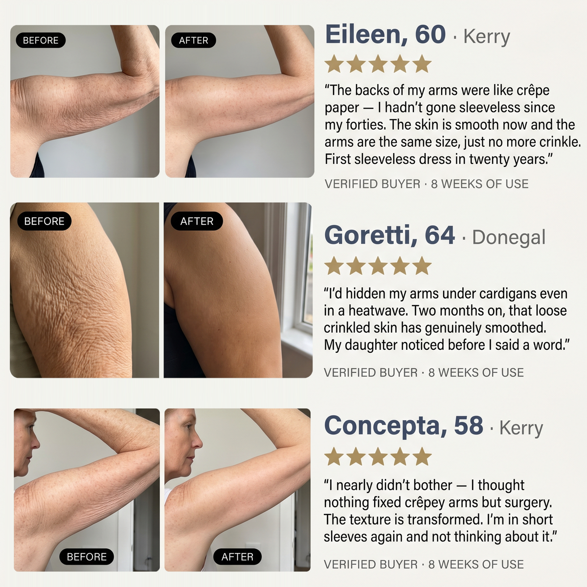 Sculpté Crepey Arm Firming Cream