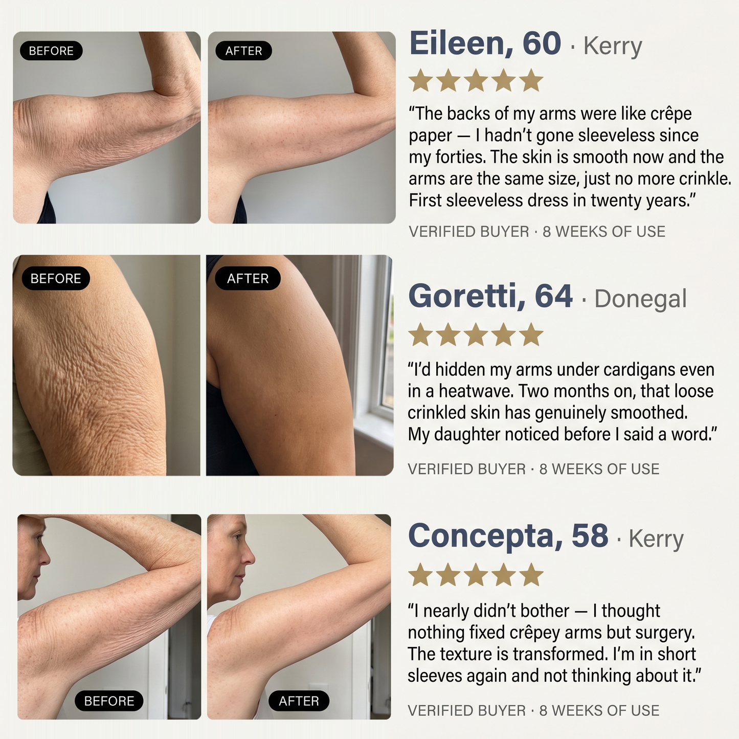 Sculpté Crepey Arm Firming Cream