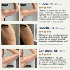 Sculpté Crepey Arm Firming Cream