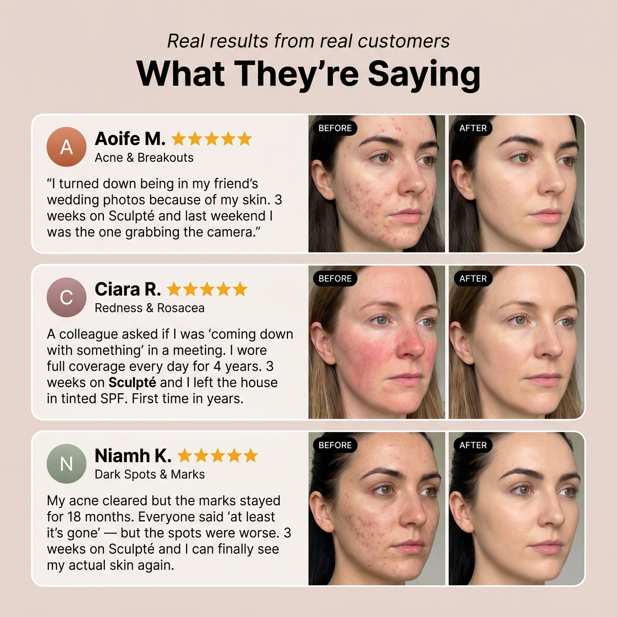 Sculpté Azelaic Acid Cream