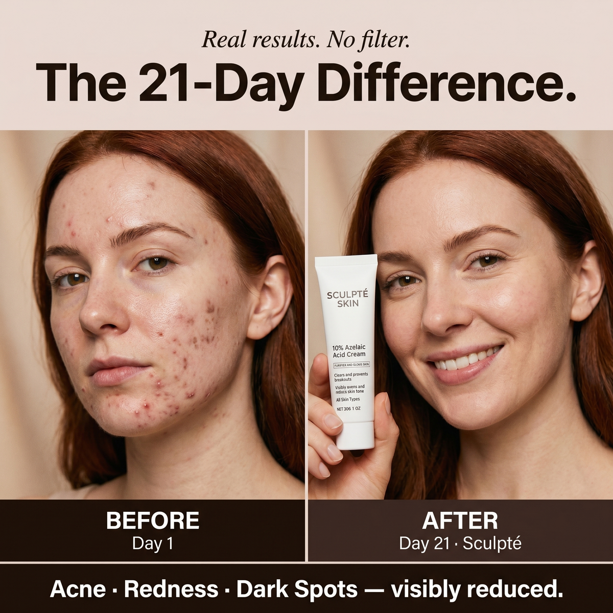 Sculpté Azelaic Acid Cream