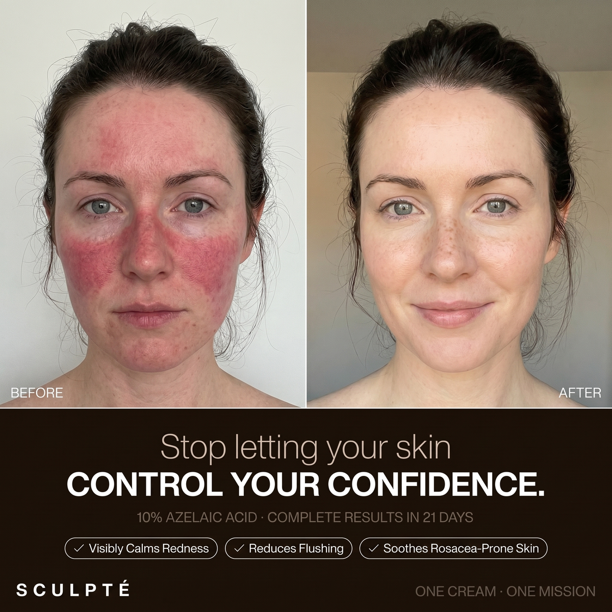 Sculpté Rosacea Cream