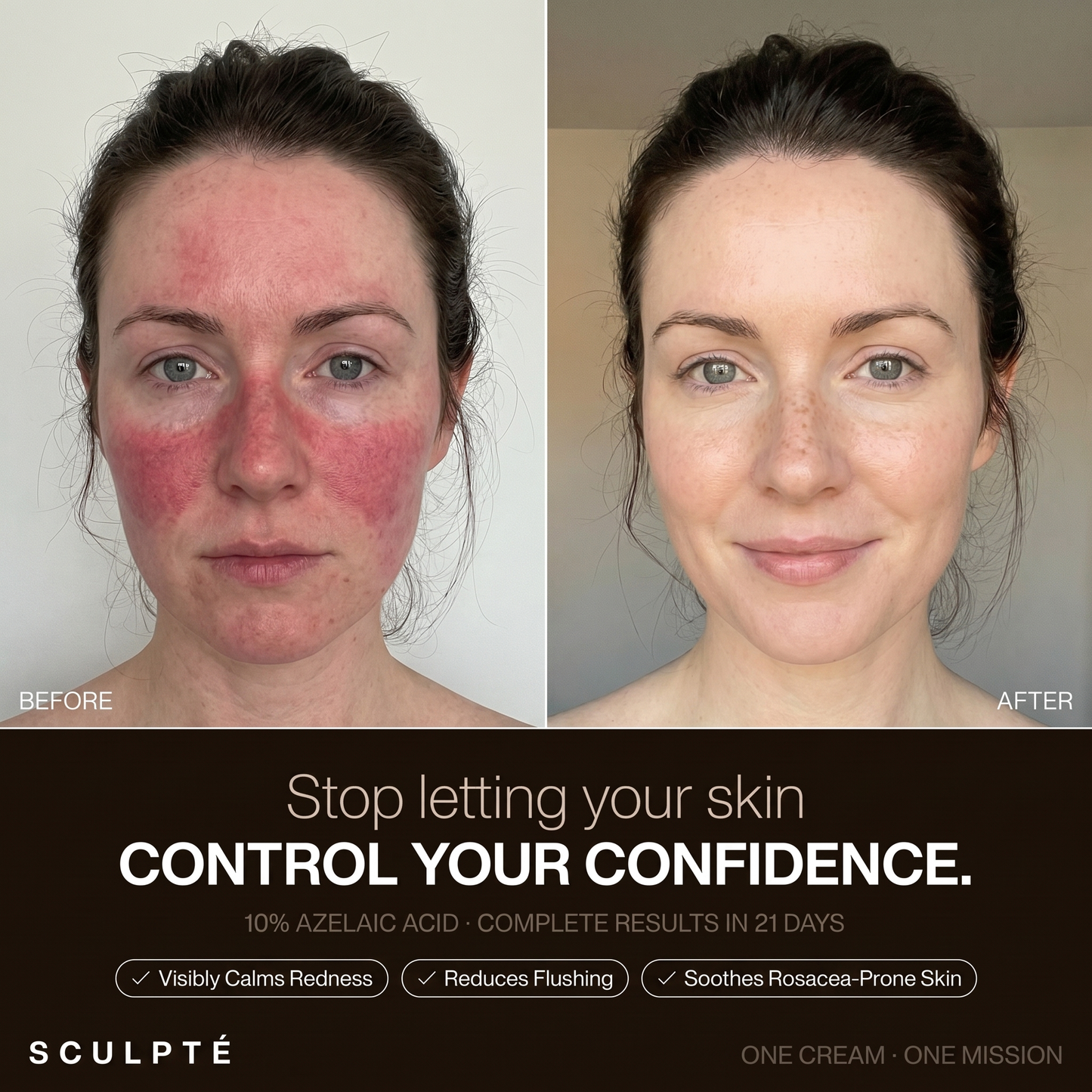 Sculpté Rosacea Cream