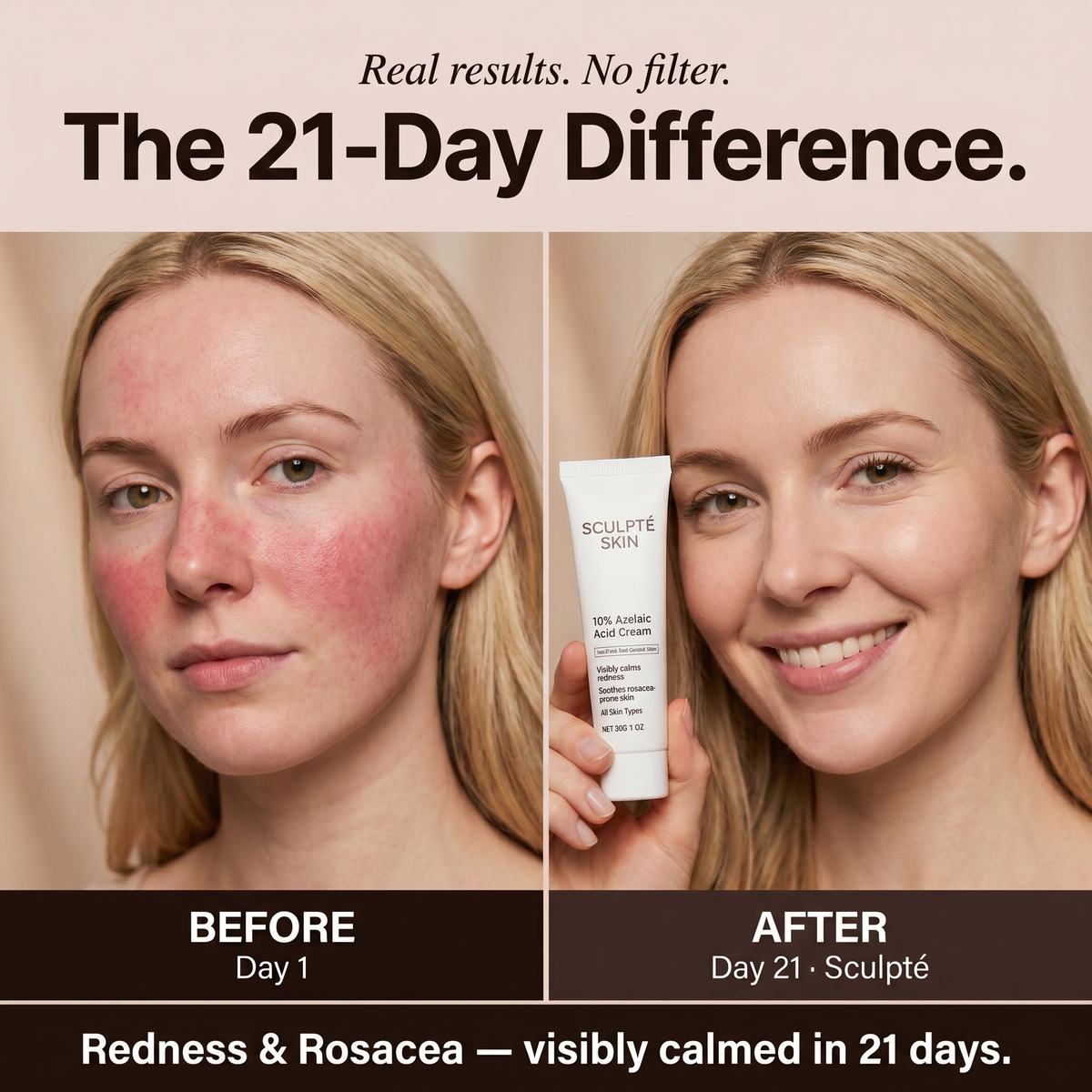 Sculpté Rosacea Cream
