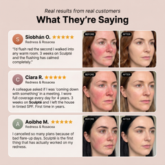 Sculpté Rosacea Cream