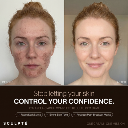 Sculpté Post-Acne Cream