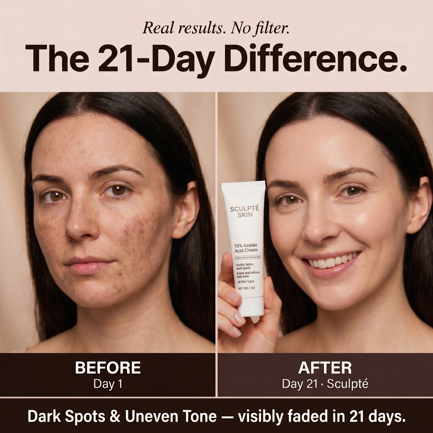 Sculpté Post-Acne Cream