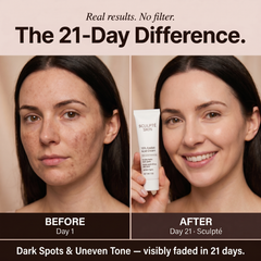Sculpté Post-Acne Cream