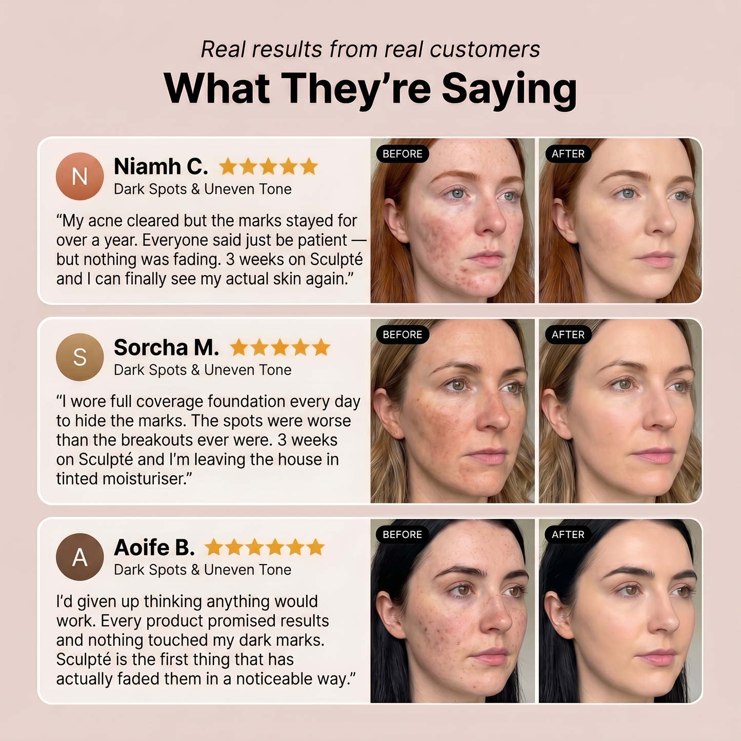 Sculpté Post-Acne Cream