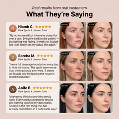 Sculpté Post-Acne Cream