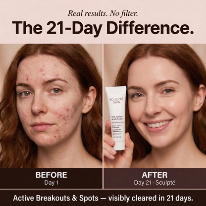 Sculpté Acne Cream
