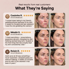 Sculpté Acne Cream